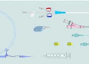 3 Lumen Hemodialysis Catheters Sets with Y-Introducer Needle - Subclavian & Femoral Approach