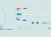 2 Lumen Hemodialysis Catheters Sets with Quick Insertion Syringe  - Internal Jugular Approach