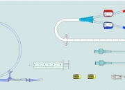 2 Lumen High Flow Hemodialysis Bent Catheters Sets - Jugular Bent