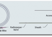Drainage Catheter Insertion Set with Amplatz Guidewire