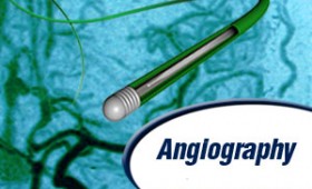 Angiography & Cath-Lab